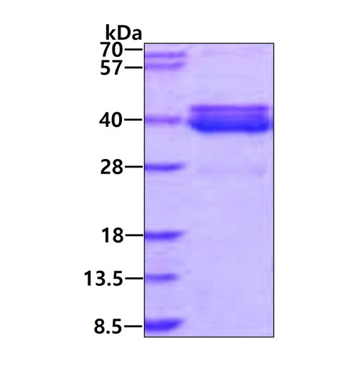 SDS-PAGE gel of recombinant human NT5C3B protein 3ug under reducing conditions stained with Coomassie blue