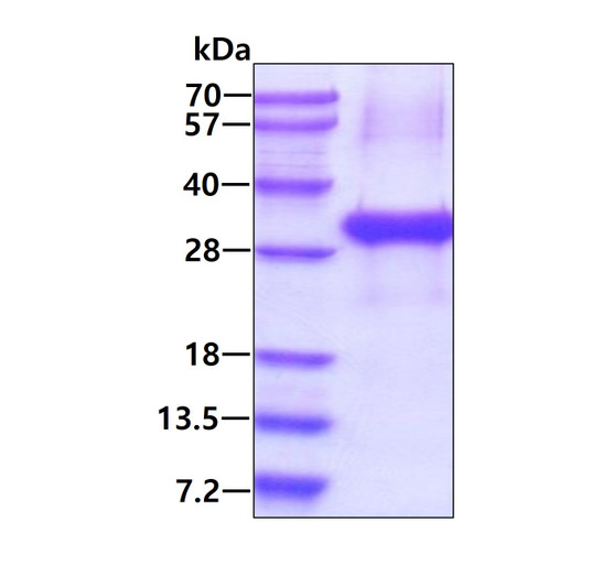 SDS-PAGE of recombinant human FGFBP1 protein 3μg Coomassie blue stain