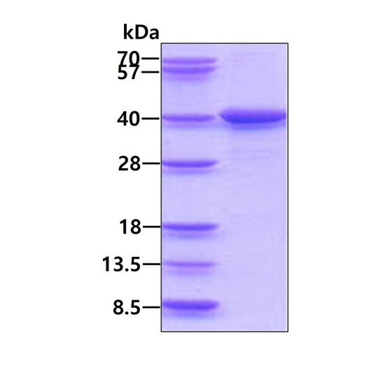 SDS-PAGE gel of recombinant human LZTFL1 protein under reducing conditions stained with Coomassie blue