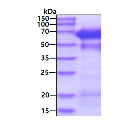 SDS-PAGE gel of recombinant human NMT1 protein under reducing conditions stained with Coomassie blue