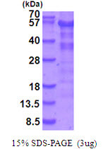 SDS-PAGE of recombinant human LKB1 STK11 protein under reducing conditions