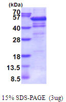 SDS-PAGE gel of recombinant human IP6K2 protein under reducing conditions Coomassie blue stain