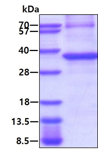 SDS-PAGE of recombinant human PPM1D protein under reducing conditions