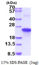 SDS-PAGE gel of recombinant human TIMP-1 protein under reducing conditions stained with Coomassie blue
