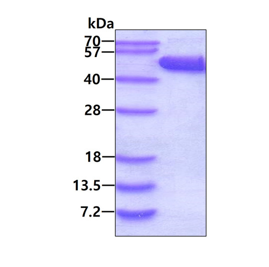 SDS-PAGE gel of recombinant human ACP6 protein 3µg under reducing conditions stained with Coomassie blue