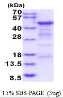SDS-PAGE of recombinant human CD4 protein under reducing conditions Coomassie blue stain