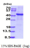 SDS-PAGE gel showing 3μg recombinant human TPST1 protein under reducing conditions Coomassie blue stain