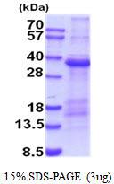 SDS-PAGE gel showing 3μg recombinant human TIM-1 KIM-1 HAVCR protein under reducing conditions Coomassie blue stain