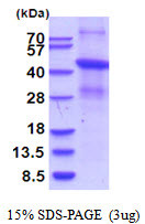 SDS-PAGE of recombinant human SR-AI MSR protein under reducing conditions