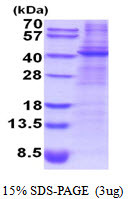 SDS-PAGE gel of recombinant human Decorin protein STJP019141 under reducing conditions Coomassie blue stain