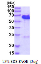 SDS-PAGE gel of recombinant human CDK5RAP3 protein 3 µg reducing conditions Coomassie stain