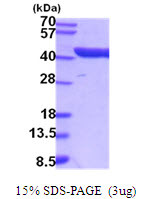 SDS-PAGE of recombinant mouse Aldoc protein under reducing conditions with Coomassie blue stain