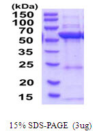 SDS-PAGE gel of recombinant human HMGCS1 protein under reducing conditions stained with Coomassie blue