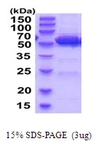 SDS-PAGE gel of recombinant mouse ALDH2 protein 3 µg reducing conditions Coomassie stain