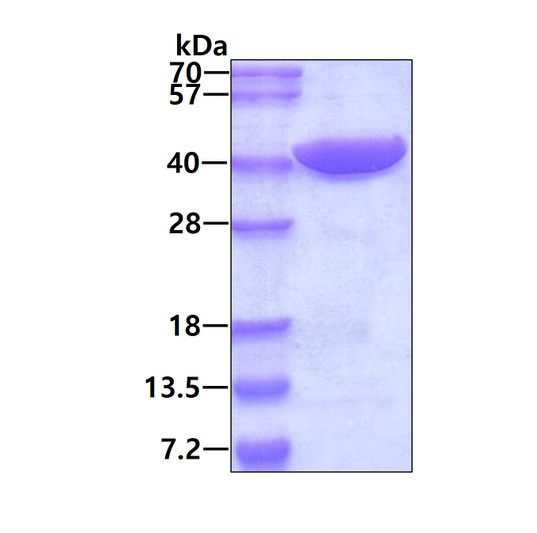 SDS-PAGE of recombinant human PRPS2 protein under reducing conditions stained with Coomassie blue