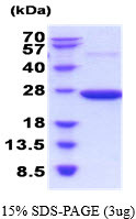 SDS-PAGE of recombinant rat Peroxiredoxin 2 PRDX2 protein under reducing conditions