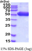SDS-PAGE gel of recombinant human PSMD5 protein 3ug under reducing conditions Coomassie blue stain
