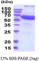 SDS-PAGE of recombinant human PP2A alpha PPP2R1A protein under reducing conditions