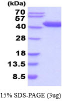 SDS-PAGE gel showing recombinant human AST1 GOT1 protein under reducing conditions stained with Coomassie blue