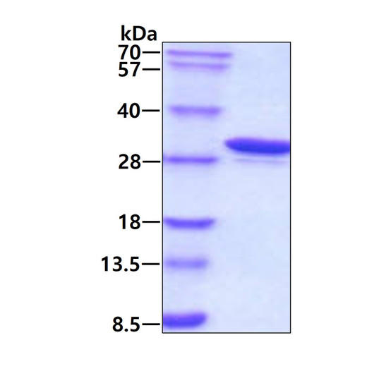SDS-PAGE gel of recombinant human Carbonic Anhydrase 1 CA1 protein under reducing conditions