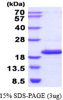 SDS-PAGE gel of recombinant human NME4 protein under reducing conditions with Coomassie blue stain