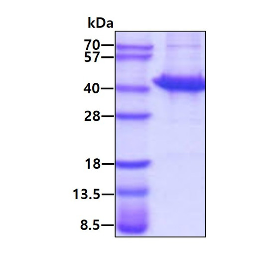 Recombinant human SORD protein SDS-PAGE gel under reducing conditions stained with Coomassie blue