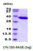 SDS-PAGE of recombinant human LDHB protein under reducing conditions Coomassie blue stain