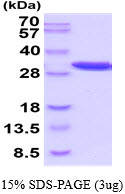 SDS-PAGE of recombinant mouse PGAM1 protein under reducing conditions