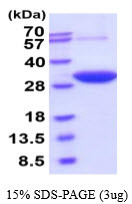 SDS-PAGE gel of recombinant human DCXR protein under reducing conditions stained with Coomassie blue