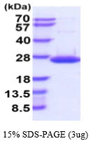SDS-PAGE gel of recombinant human DUSP18 protein 3µg under reducing conditions stained with Coomassie blue