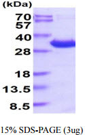 SDS-PAGE gel of recombinant human 14-3-3 epsilon protein under reducing conditions