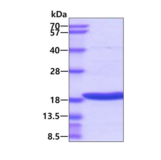 SDS-PAGE gel of recombinant human TRAIL TNFSF10 protein under reducing conditions Coomassie stain