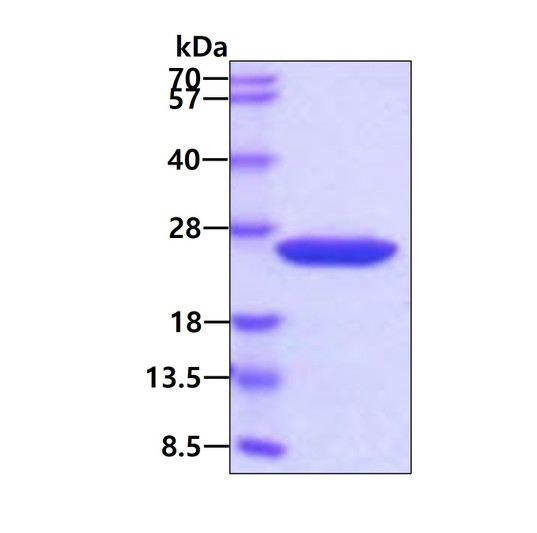 SDS-PAGE of recombinant mouse Cyclophilin B PPIB protein under reducing conditions