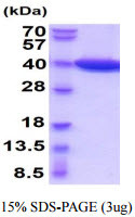 SDS-PAGE gel of recombinant mouse LDHB protein stained with Coomassie blue
