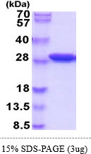 SDS-PAGE gel of recombinant mouse sepiapterin reductase SPR protein under reducing conditions