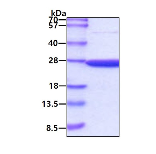 SDS-PAGE gel showing recombinant mouse Peroxiredoxin 2 PRDX2 protein under reducing conditions