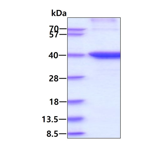 SDS-PAGE of recombinant human HLA-G protein 3μg under reducing conditions Coomassie blue stain