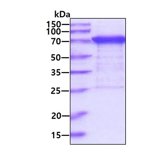 SDS-PAGE gel of recombinant human PP2C gamma PPM1G protein under reducing conditions