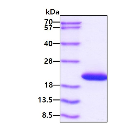 SDS-PAGE of recombinant mouse IL-1Ra IL1RN protein under reducing conditions with Coomassie blue stain