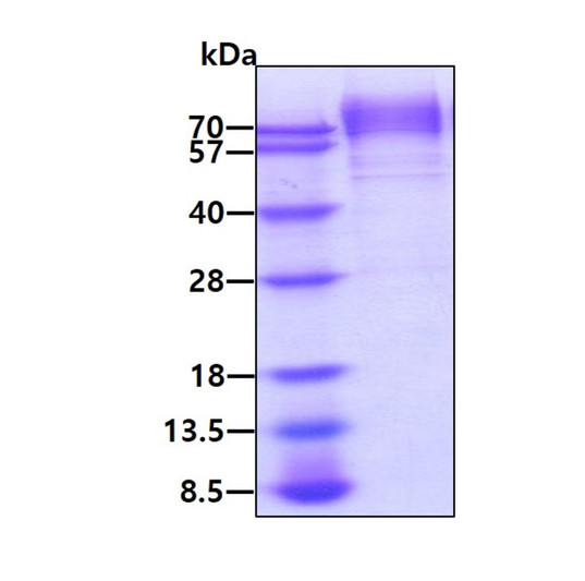SDS-PAGE of recombinant mouse Thrombopoietin protein under reducing conditions