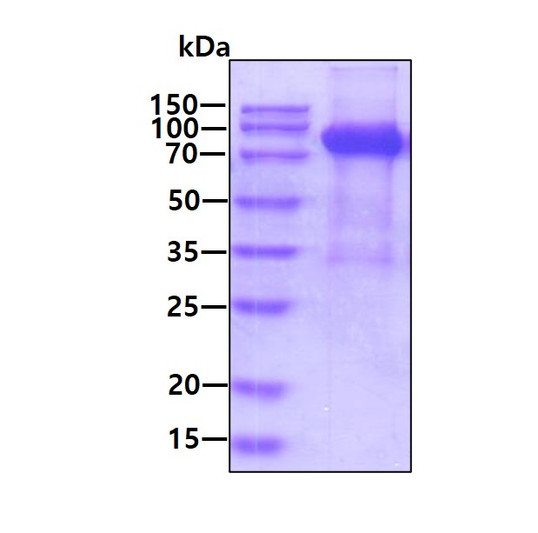 SDS-PAGE of recombinant rat UNC5H2 UNC5B protein under reducing conditions