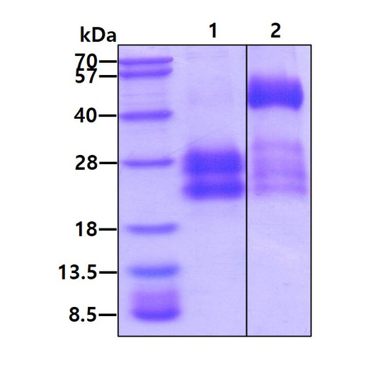 SDS-PAGE of recombinant human IL-17E IL-25 protein under reducing and non-reducing conditions