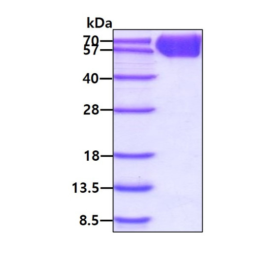 SDS-PAGE of recombinant human PD-1 protein under reducing conditions with Coomassie blue stain