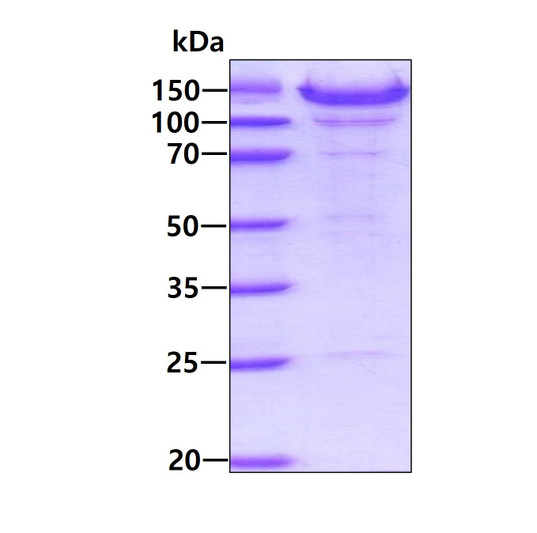 SDS-PAGE gel of recombinant mouse Thrombospondin 4 protein under reducing conditions stained with Coomassie blue