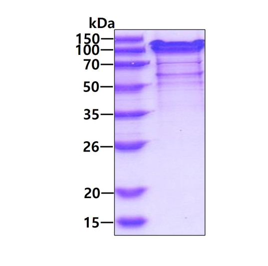 SDS-PAGE of recombinant human Thrombospondin 5 COMP protein under reducing conditions