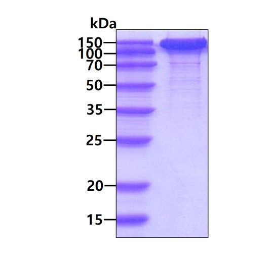 SDS-PAGE gel showing recombinant human TIE1 protein 3µg under reducing conditions Coomassie blue stain