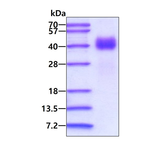 SDS-PAGE gel of recombinant mouse DKK1 protein 3μg under reducing conditions stained with Coomassie blue