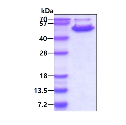 SDS-PAGE of recombinant SARS-CoV-2 nucleocapsid protein under reducing conditions with Coomassie blue staining