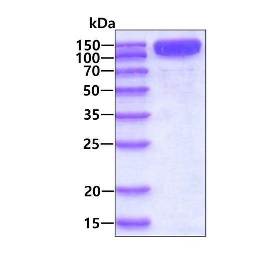 SDS-PAGE gel of recombinant rat TrkA protein 3 µg under reducing conditions Coomassie blue stain