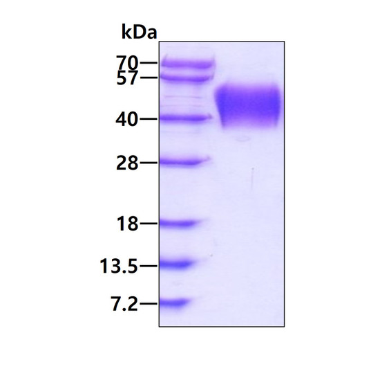 SDS-PAGE gel showing recombinant human CD16a FCGR3A protein under reducing conditions